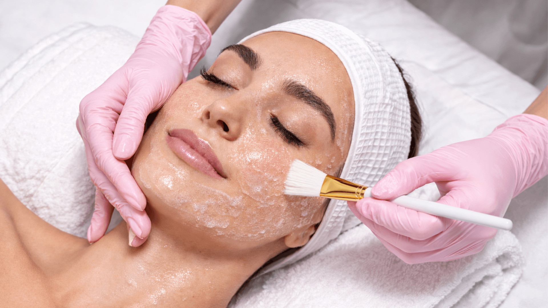 Professional Chemical Peels in Overland Park, KS